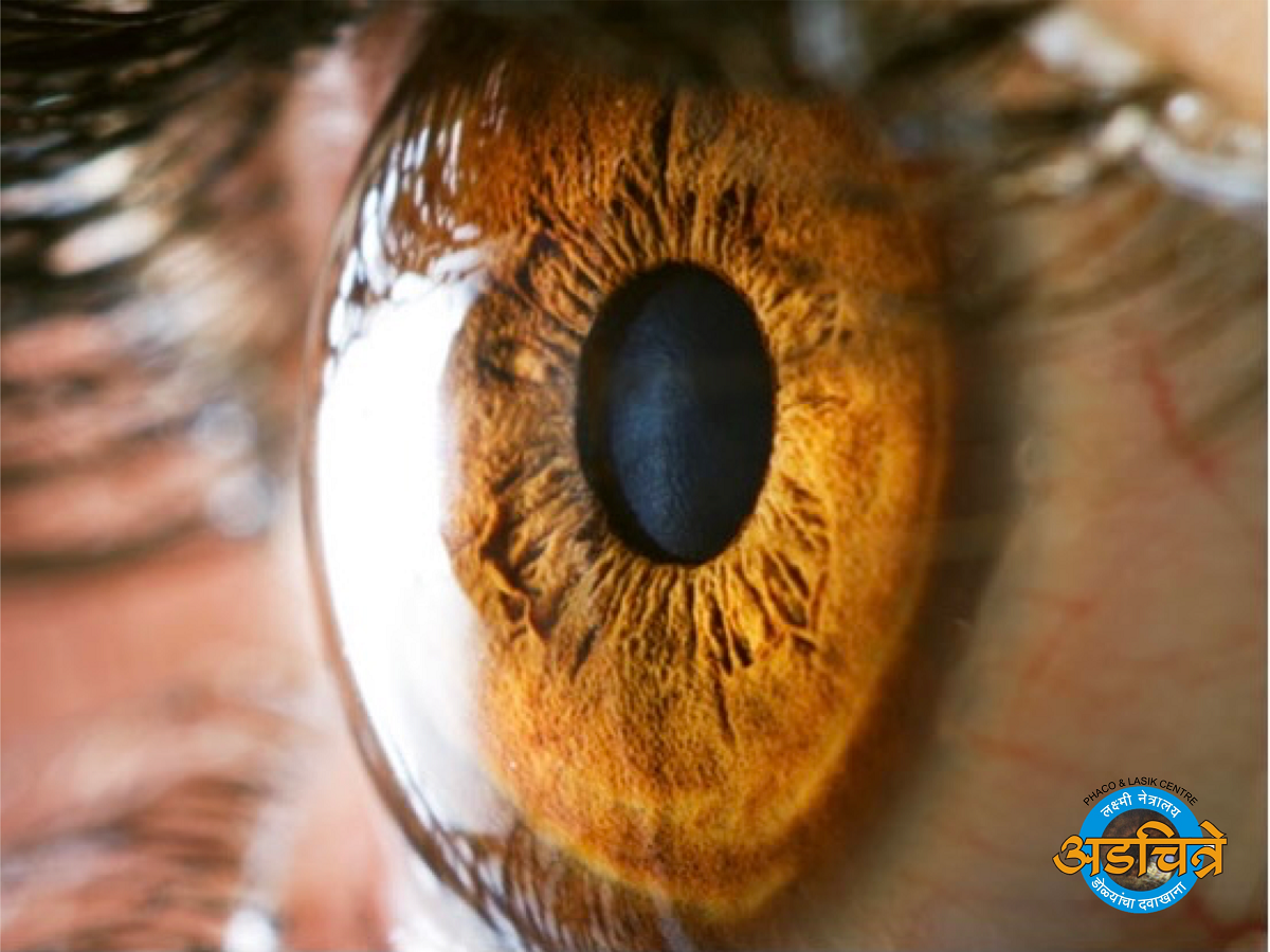 Eye Image