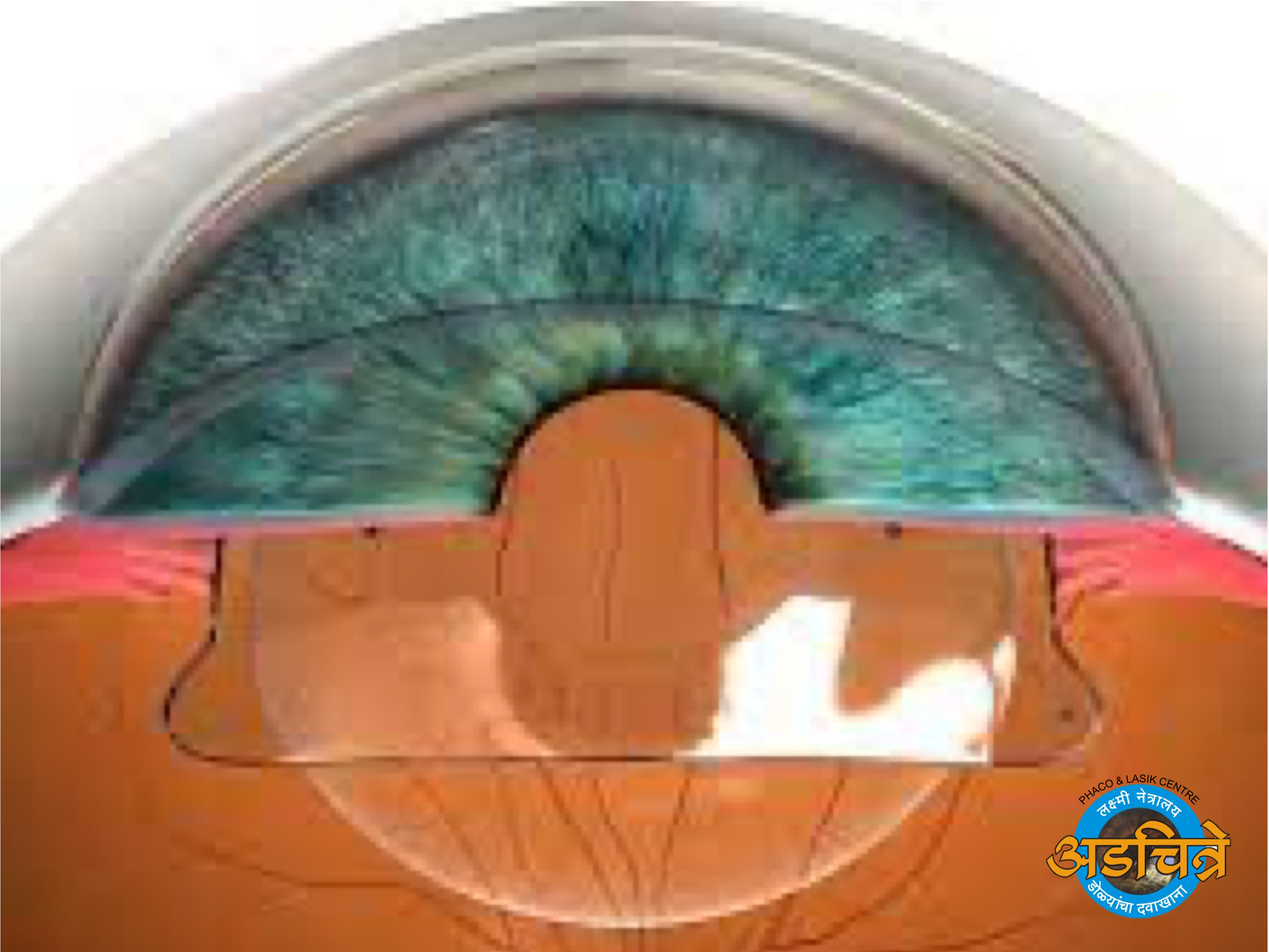 Retina - Eye Hospital