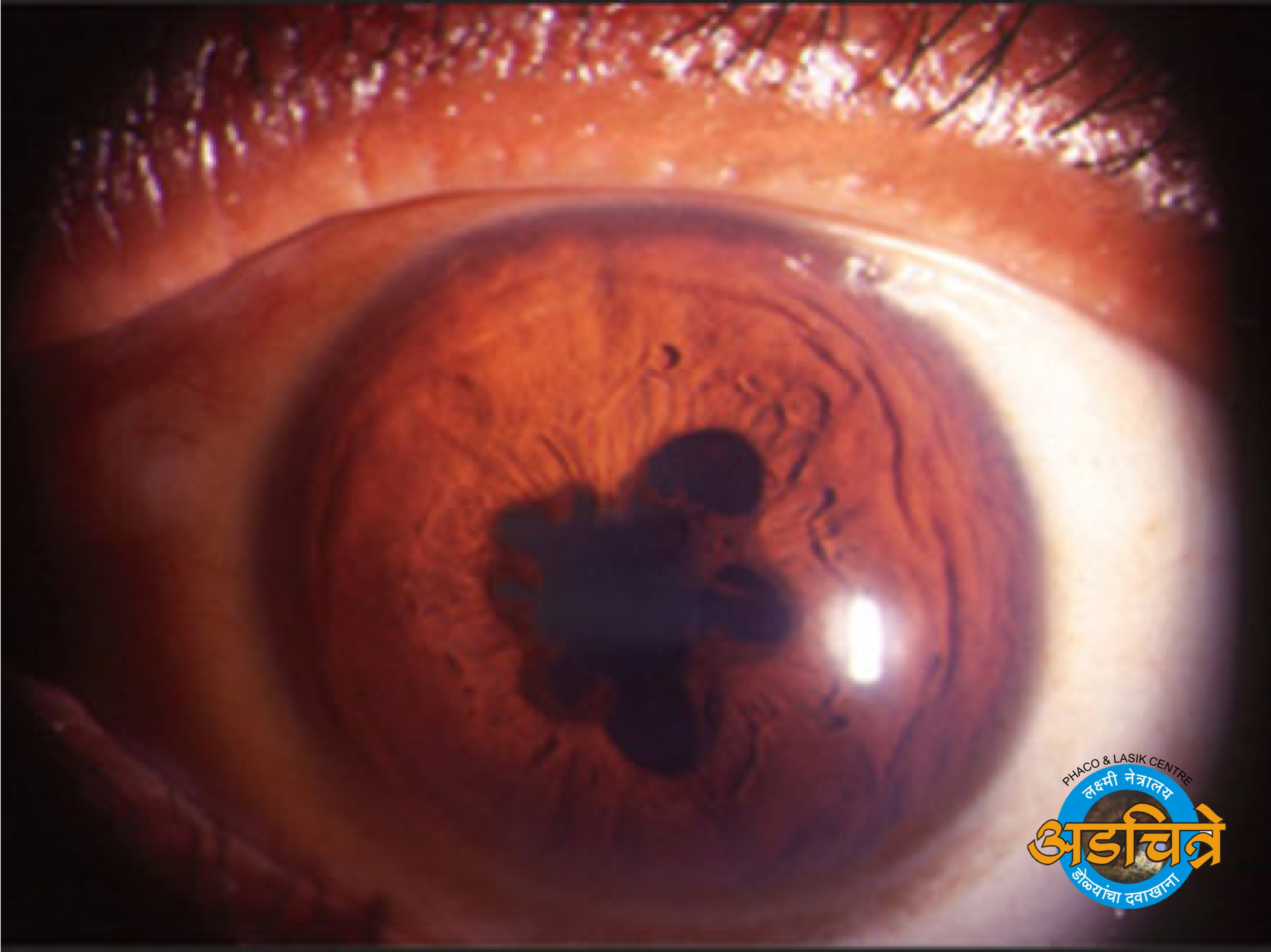 Adchitre Eye Hospital