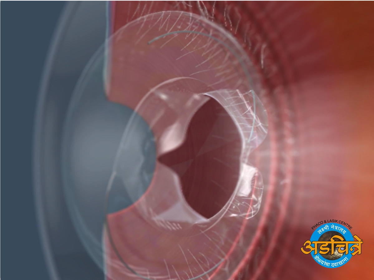 Eye Hospital